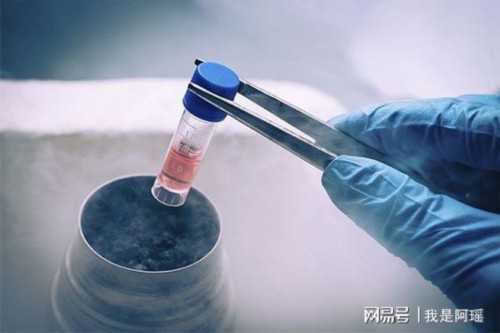 <strong>郑州供卵代怀男宝宝费用解析，试管前准备与手术成本全指南</strong>